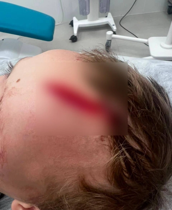 Видно, что рана глубокая — ее, по словам родных, пришлось зашивать в больнице | Источник: Дарья Донцова / T.me