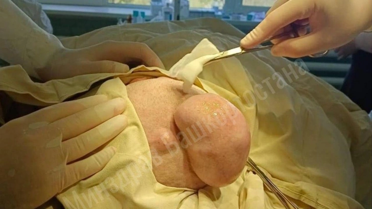 Источник: телеграм-канал «Минздрав Башкортостана»