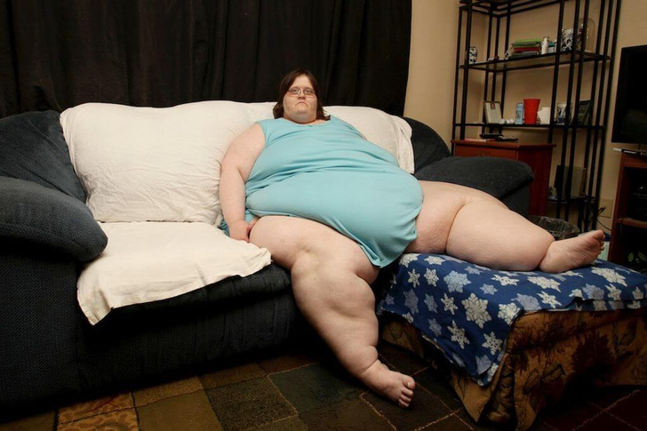 «Я лучше умру, чем буду так жить»: история женщины, которая весила 350 килограммов