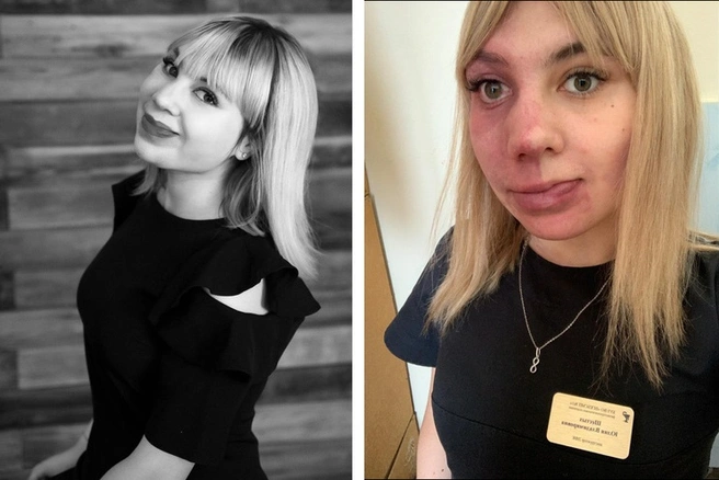Юлия стала понимать, что с ней что-то не так, только подростком | Источник: Юлия Шестых