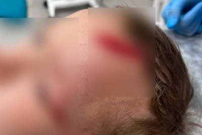 Семилетний внук Дарьи Донцовой пострадал от нападения собаки
