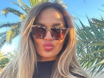 Синяки, бинты и глаза-щелочки: жена экс-участника «ДОМа-2» Саши Задойнова напугала подписчиков перекроенным лицом