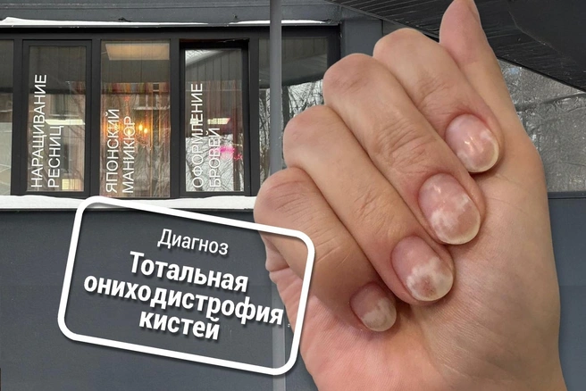 Это на ногтях Маши Токмаковой японский маникюр. Последствия процедуры она лечит до сих пор | Источник: Мария Токмакова / 72.RU, Дмитрий Гладышев / 72.RU