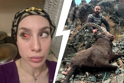 Сибирячка обвинила бывшего в похищении сына и избиении до травмы глаза