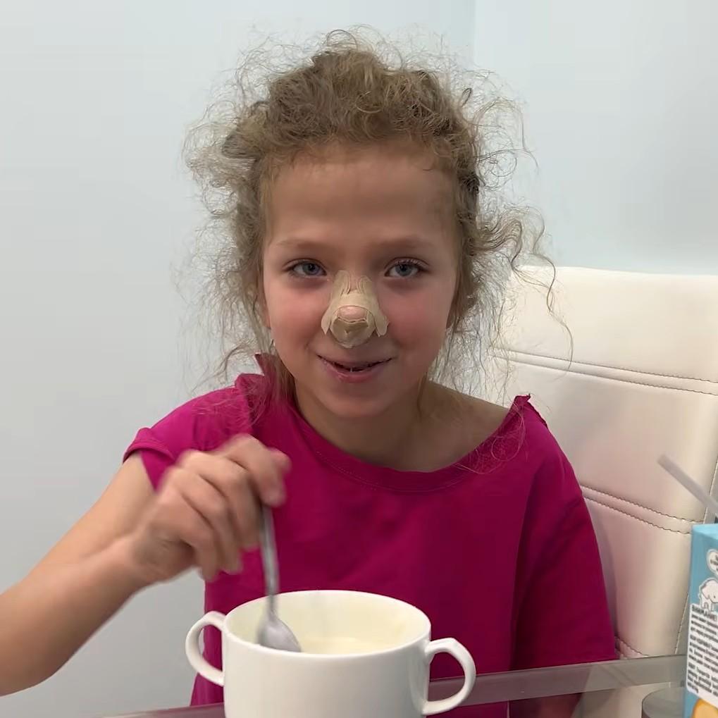 11-летняя Варя впервые увидела свой нос после пластики: «Красивее, чем старый!»