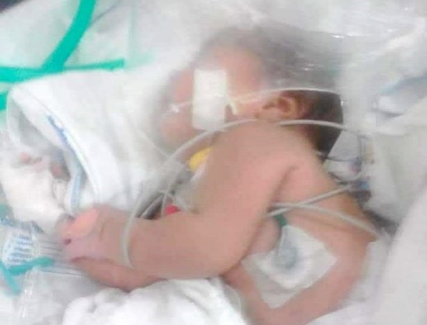 Новорожденная девочка выжила после семи укусов смертоносного скорпиона