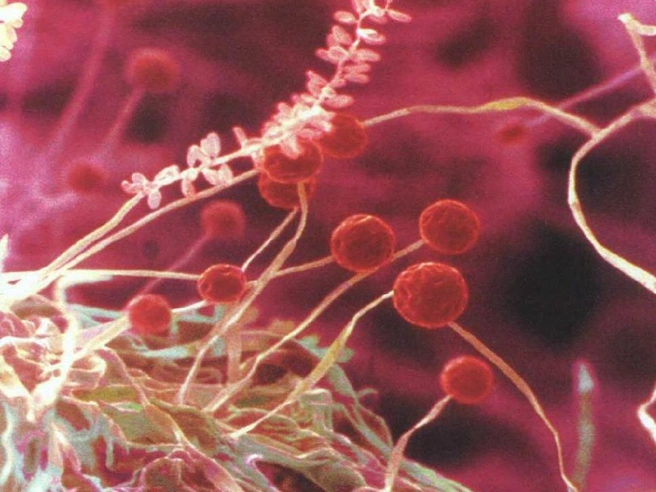 Грибы рода Aureobasidium называют «черными дрожжами». Они и в самом деле могут жить, подобно дрожжам, в виде одиночных клеток, а могут образовывать переплетения гифов, характерные для плесневых грибов. Представители этого рода отличаются любовью к масляным краскам — они портят творения художников и крашеные оконные рамы | Источник: SPL / EAST NEWS