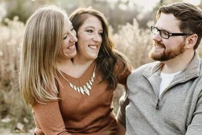 Abby and Brittany Hensel marry and have a baby