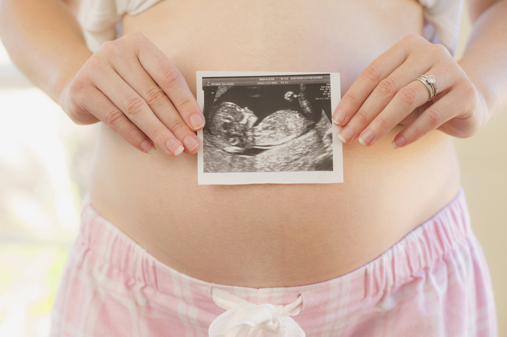 Беременная узнала, что из-за редкой аномалии ей придется рожать дважды