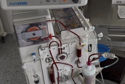 В Астрахани применяют каскадную плазмофильтрацию против опасного холестерина