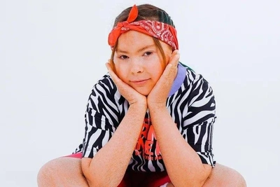 Novosibirsk Schoolgirl Thrives Despite Rare Ichthyosis Condition