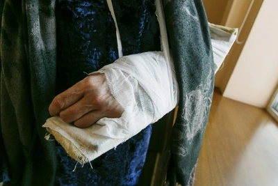 В Забайкалье более 80 тысяч травмирований среди взрослых и детей