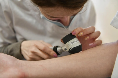 Минздрав сообщил о числе больных ихтиозом в регионе