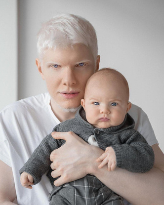 Как выглядит ребенок самого красивого альбиноса и грузинской модели
