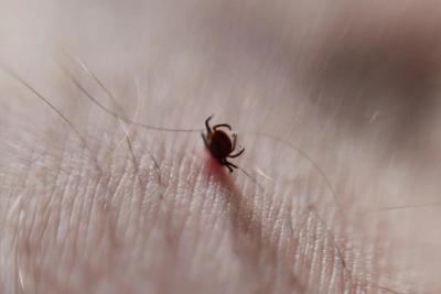 В Курганской области ребенка укусил клещ