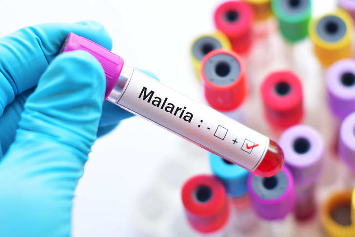 Коксаки, малярия и другие: какие вирусы дети привозят из-за границы