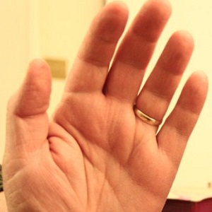 Короткие Пальцы Фото