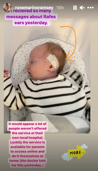 Британская инста-мать отправила своего трехнедельного сына на процедуру коррекции формы ушей
