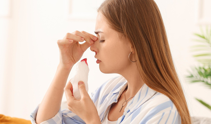 Носовое кровотечение: симптомы, диагностика, профилактика и лечение
