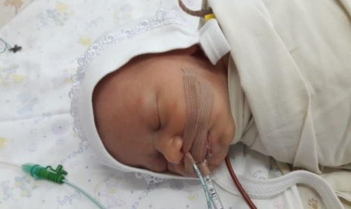 Новорождённому Егору срочно нужна операция на сердце