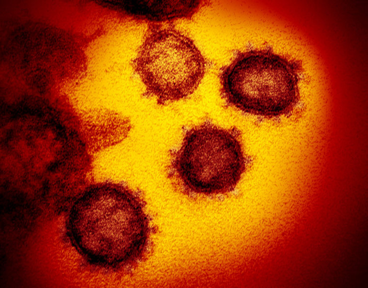 Фото №1 - Ученые опубликовали фотографии коронавируса (галерея)