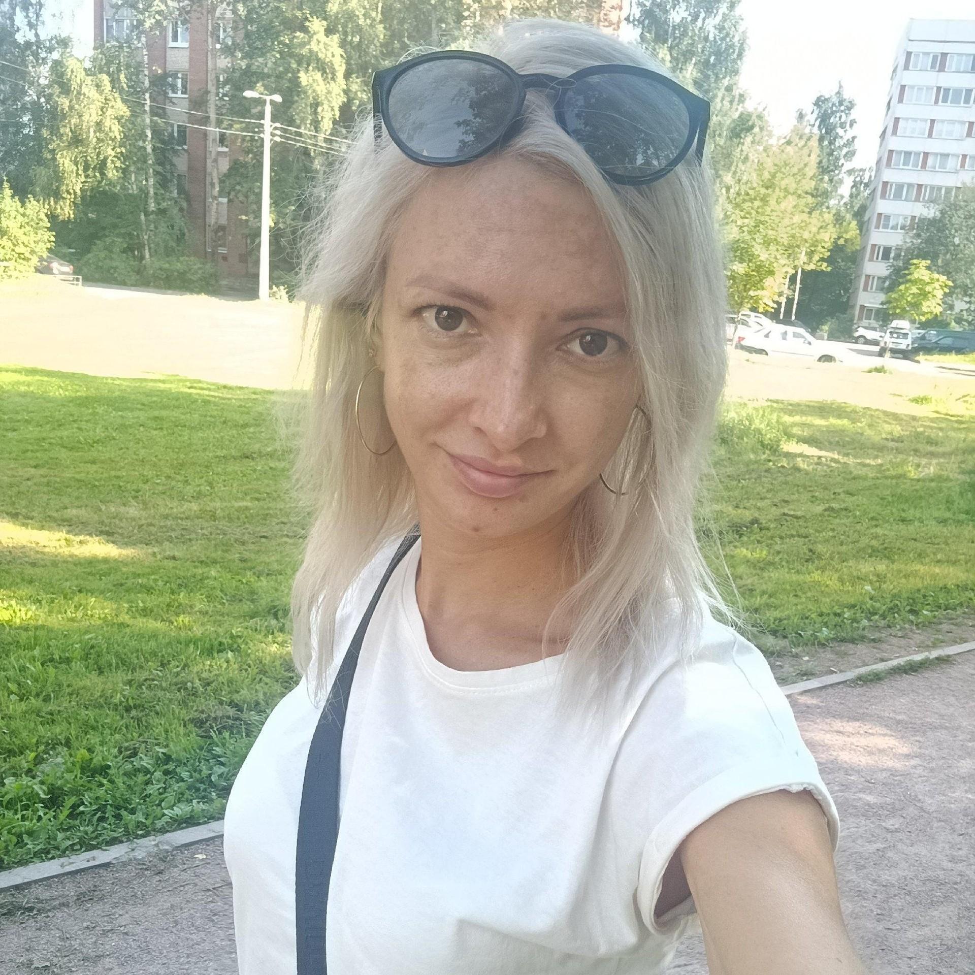 «Я видела, как сползает моя кожа, череп оголился…»: как выглядит Инна Цыбасова, которую подожгла жена любовника