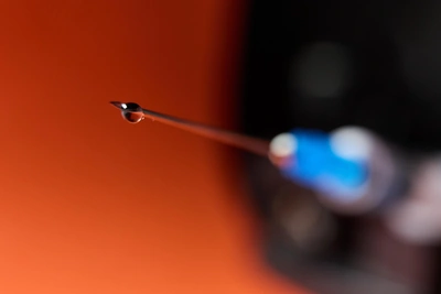 Бешенство в Уфе: карантин возле УМПО после смерти человека