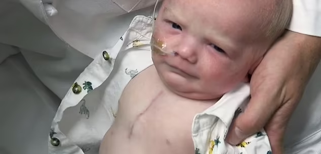 Новое сердце для Оуэна: как хирурги спасли младенца, который родился со сросшимися сосудами