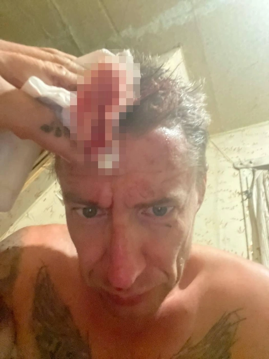 Битой Василию серьезно травмировали голову | Источник: Василий Савочкин