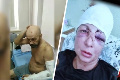 В Омске возбудили дело о жестоком избиении