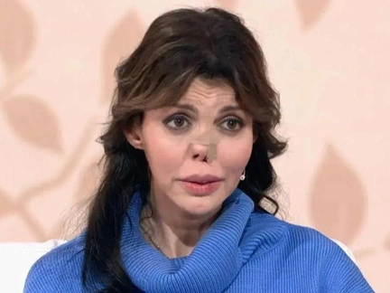 «Я буду скучать по врачу, горе нас сблизило»: Алиса Аршавина показала результат после финальной операции на нос