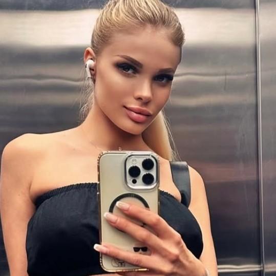 Модель Анжелика Тартанова помирилась с любовником — бизнесменом Дмитрием Кузьминым, лишившим ее полголовы