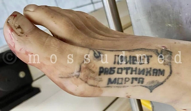 Есть в коллекции Алексея и такое фото. Как вам такой привет? | Источник: Mossudmed / T.me
