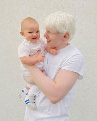 Как выглядит ребенок самого красивого альбиноса и грузинской модели