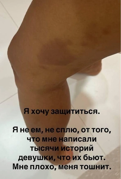 Источник: __angelna.g / instagram (экстремистская организация, деятельность запрещена на территории РФ)