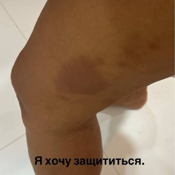 Источник: __angelna.g / instagram (экстремистская организация, деятельность запрещена на территории РФ)