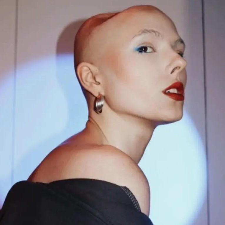 21-летняя блогерша Ира Небога умерла после пяти лет борьбы с раком