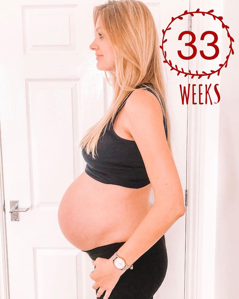 Фото №4 - Женщина забеременела сыном. А через три недели — еще и дочкой