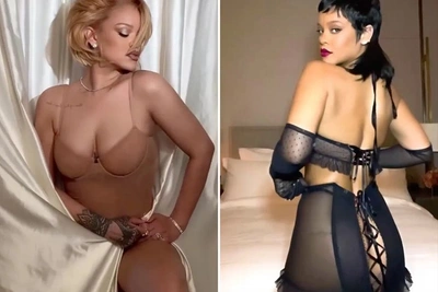 Рианна: гены или хирург?