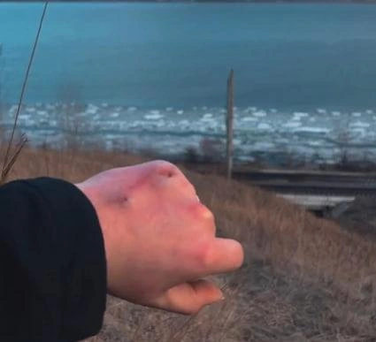 Собаки укусили девушку за руку | Источник: Мария Карпова