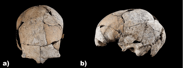 Боль была невыносимой: найден череп человека со следами самой древней операции