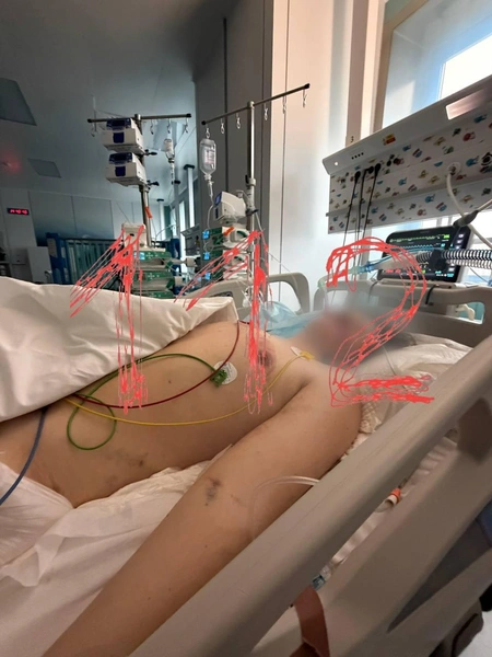 Рома в критическом состоянии