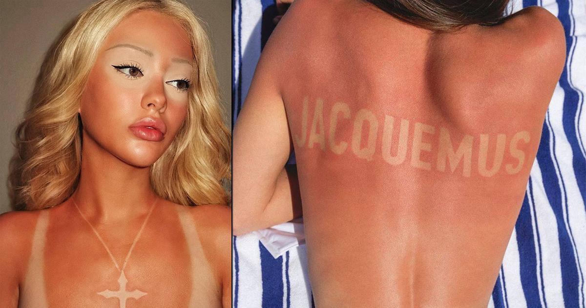 Поцелованные солнцем: почему tan lines нравятся модницам, но ужасают врачей