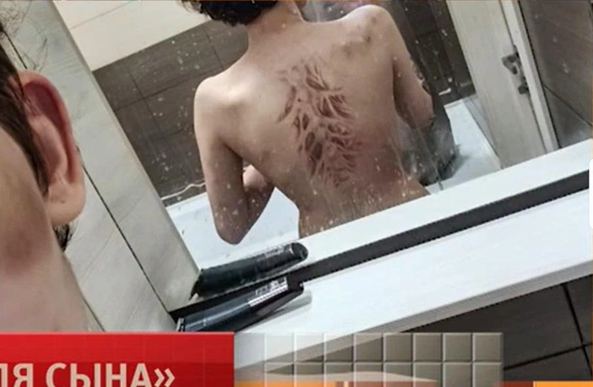 Иногда Дмитрий настолько сильно избивал девушек, что те не могли самостоятельно передвигаться | Источник: «Пусть говорят» / Первый канал