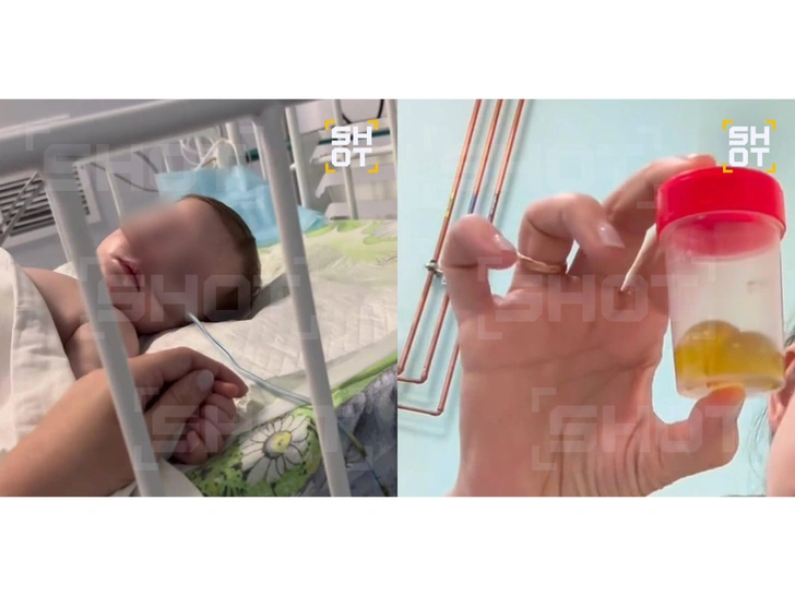 Вот те самые злополучные шарики, которые едва не стали причиной смерти малыша