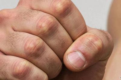 Нападение на полицейского в наркодиспансере Камчатки