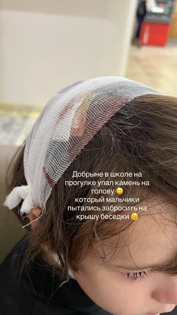 Добрыня теперь ходят с повязкой на голове