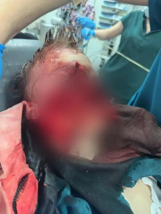 Валя Королев до сих пор находится в больнице, ему предстоит множество операций | Источник: предоставлено SOCHI1.RU