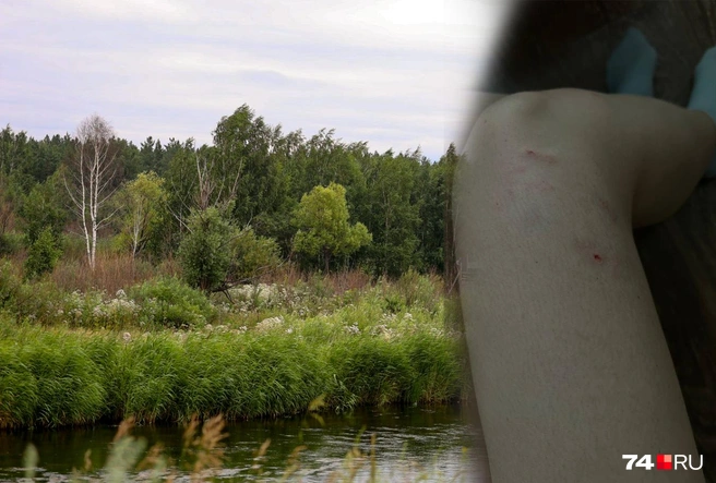 Собаки напали на девушку в городском бору, недалеко от Университетской Набережной | Источник: Наталья Лапцевич; читатель 74.RU
