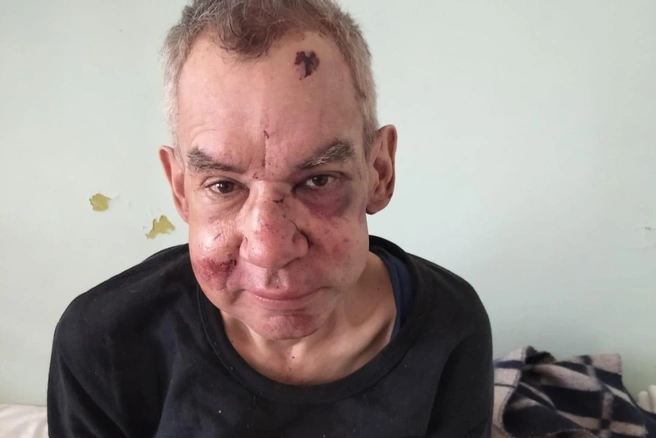 Сейчас 53-летний Алексей Дементьев госпитализирован | Источник: Кирилл Дементьев